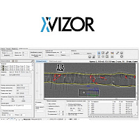 X-Vizor - ПО для компьютерной радиографии